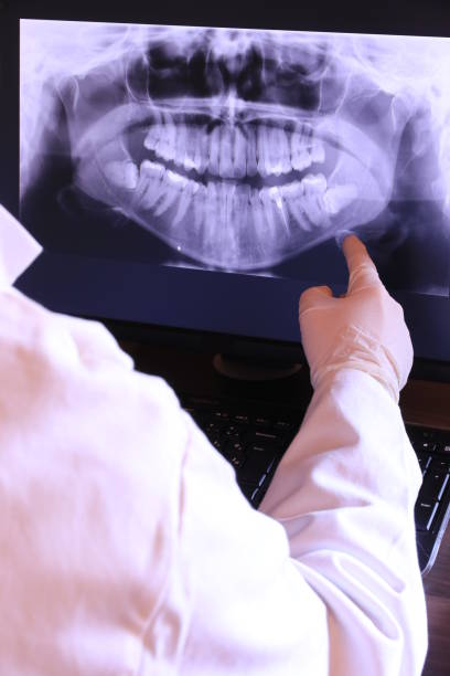 Best Dentist for Tooth Abscess  in Fort Loramie, OH
