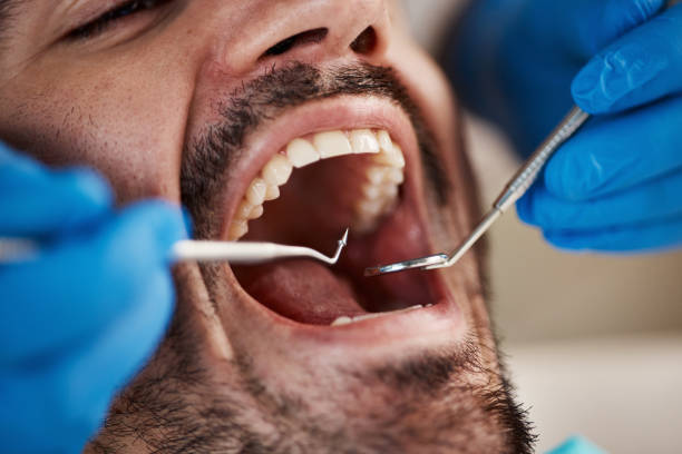 Best Broken Tooth Emergency  in Fort Loramie, OH