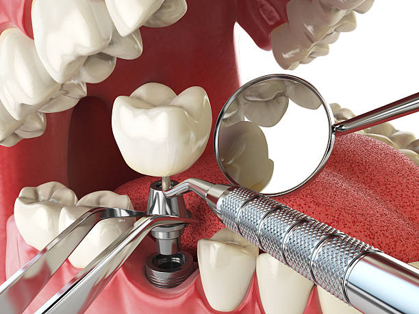 Emergency Dentist Open Today in OH