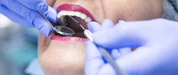 Best Emergency Tooth Extraction  in Fort Loramie, OH